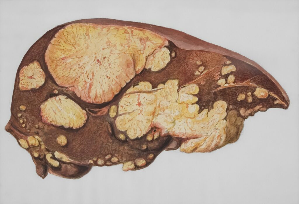liver detox